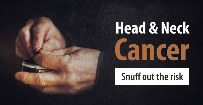 Head & Neck Cancer: Snuff Out The Risk