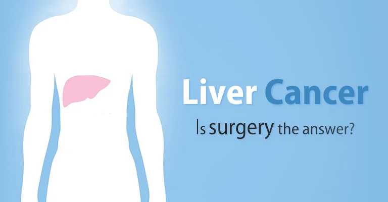 Liver Cancer: Is Surgery The Answer?