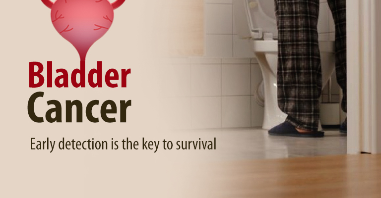 Bladder Cancer: Early Detection Is The Key To Survival