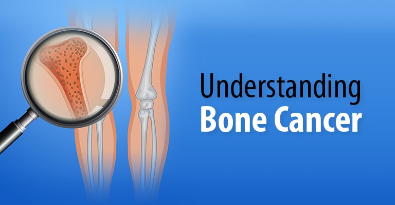 Understanding Bone Cancer